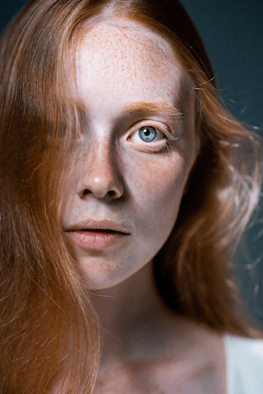 Dense freckling: In distribution. Freckles read one by one across the cheek and nose rather than smearing into a single tone.